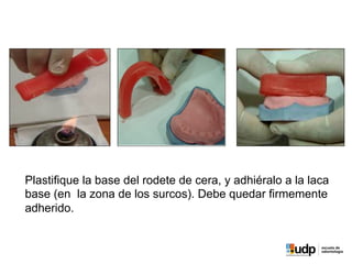 Plastifique la base del rodete de cera, y adhiéralo a la laca
base (en la zona de los surcos). Debe quedar firmemente
adherido.
 