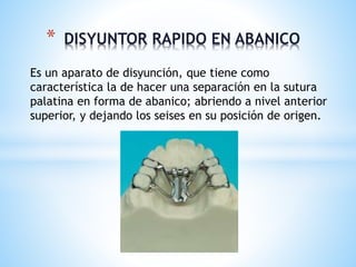 * DISYUNTOR RAPIDO EN ABANICO 
Es un aparato de disyunción, que tiene como 
característica la de hacer una separación en la sutura 
palatina en forma de abanico; abriendo a nivel anterior 
superior, y dejando los seises en su posición de origen. 
 