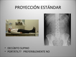 PROYECCIÓN ESTÁNDAR
• DECÚBITO SUPINO
• PORTÁTIL?? PREFERIBLEMENTE NO
 