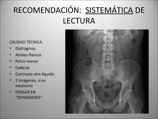 RECOMENDACIÓN: SISTEMÁTICA DE
LECTURA
CALIDAD TÉCNICA:
• Diafragmas
• Ambos flancos
• Pelvis menor
• Caderas
• Contraste aire-liquido
• 2 Imágenes, si es
necesario
• PENSAR EN
“DENSIDADES”
 