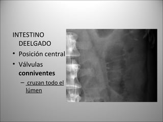 INTESTINO
DEELGADO
• Posición central
• Válvulas
conniventes
– cruzan todo el
lúmen
 