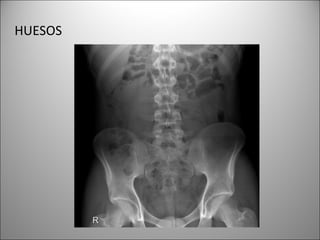 HUESOS
 