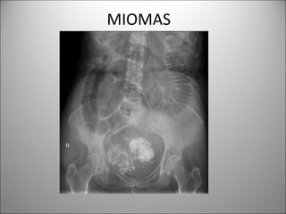 MIOMAS
 