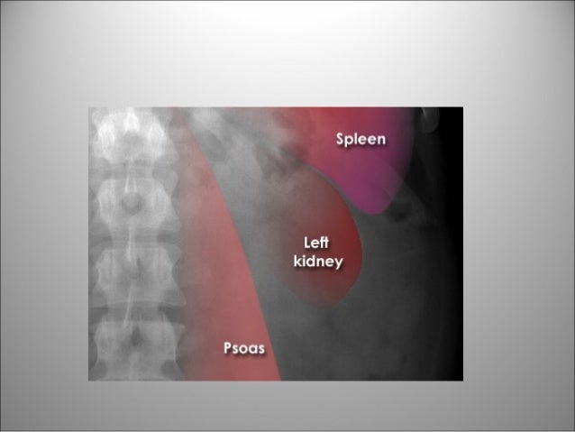 Las medicinas el indio la osteocondrosis
