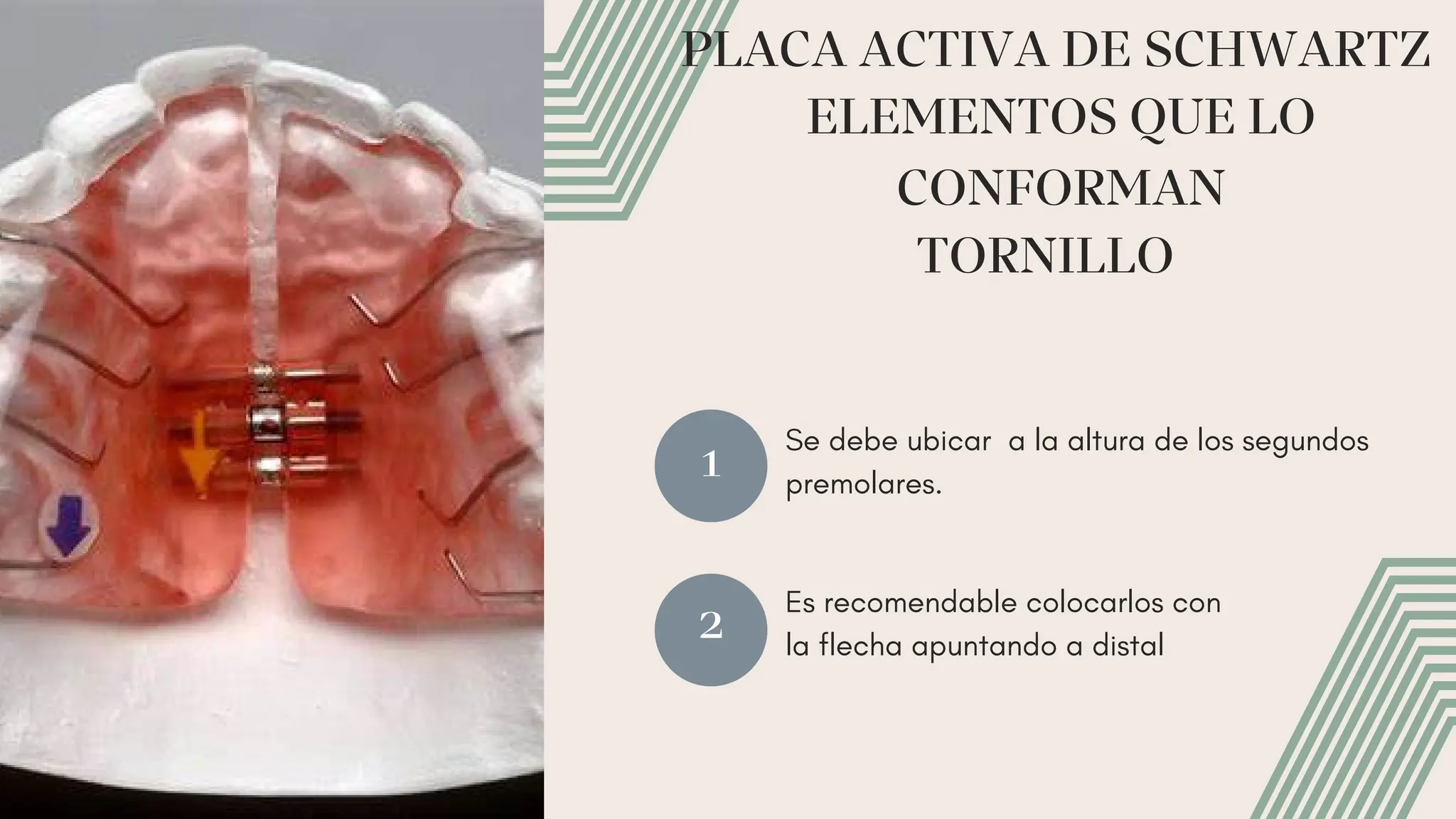 Placas Swartz. historia,ventajas, desventajas, indicaciones | PDF