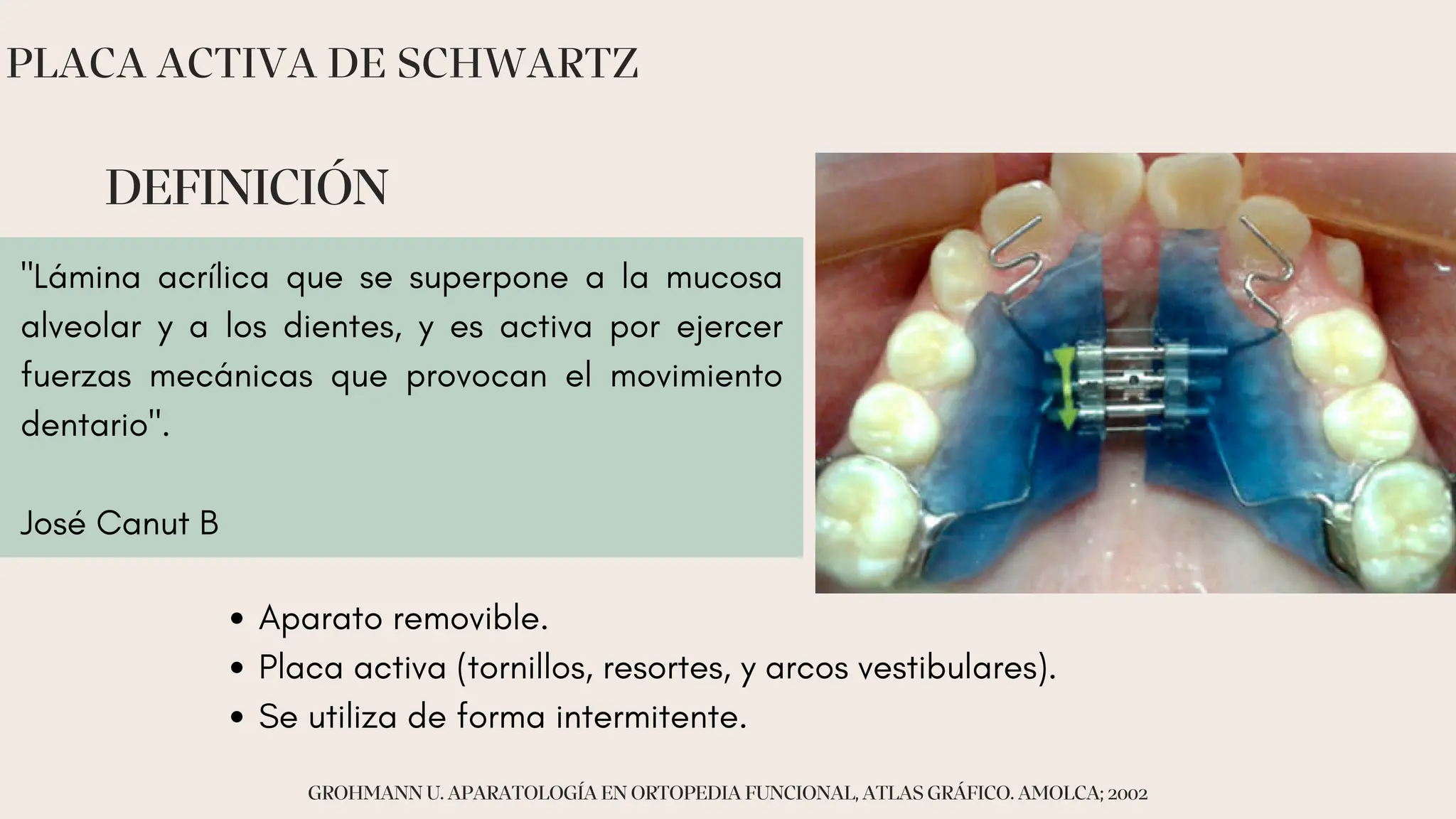 Placas Swartz. historia,ventajas, desventajas, indicaciones | PDF