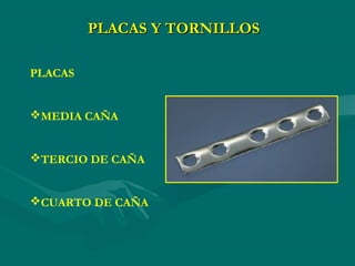 PLACAS Y TORNILLOS
PLACAS
MEDIA CAÑA
TERCIO DE CAÑA
CUARTO DE CAÑA
 