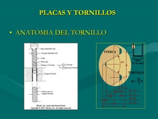 Placas y tornillos
• ANATOMIA DEL TORNILLO
 