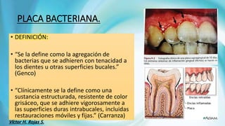 PLACA BACTERIANA.
• DEFINICIÓN:
• “Se la define como la agregación de
bacterias que se adhieren con tenacidad a
los dientes u otras superficies bucales.”
(Genco)
• “Clínicamente se la define como una
sustancia estructurada, resistente de color
grisáceo, que se adhiere vigorosamente a
las superficies duras intrabucales, incluidas
restauraciones móviles y fijas.” (Carranza)
Víctor H. Rojas S.
 