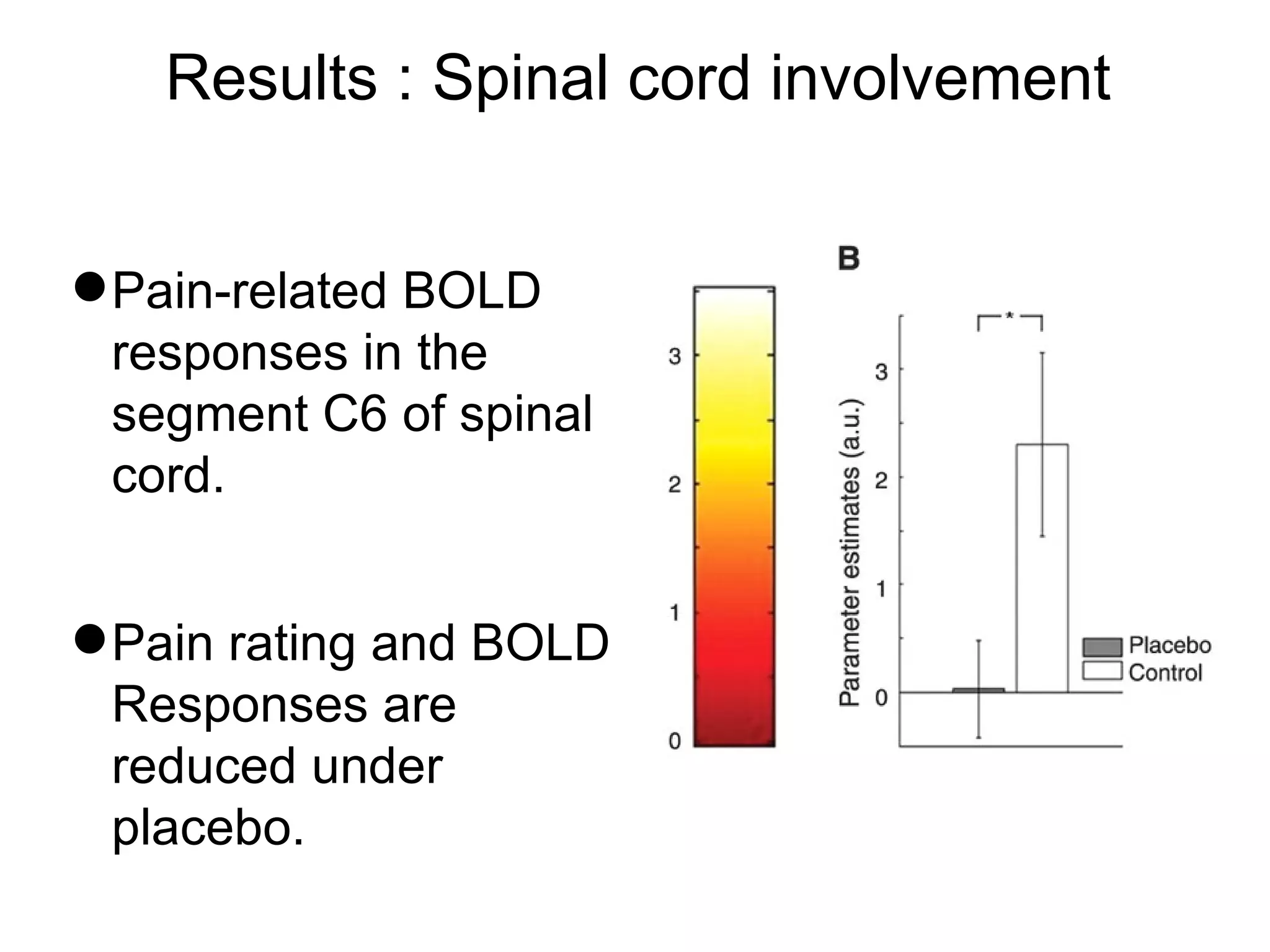 Results : Spinal cord involvement Pain-related BOLD responses in the segment C6 of spinal cord. Pain rating and BOLD Responses are reduced under placebo. 