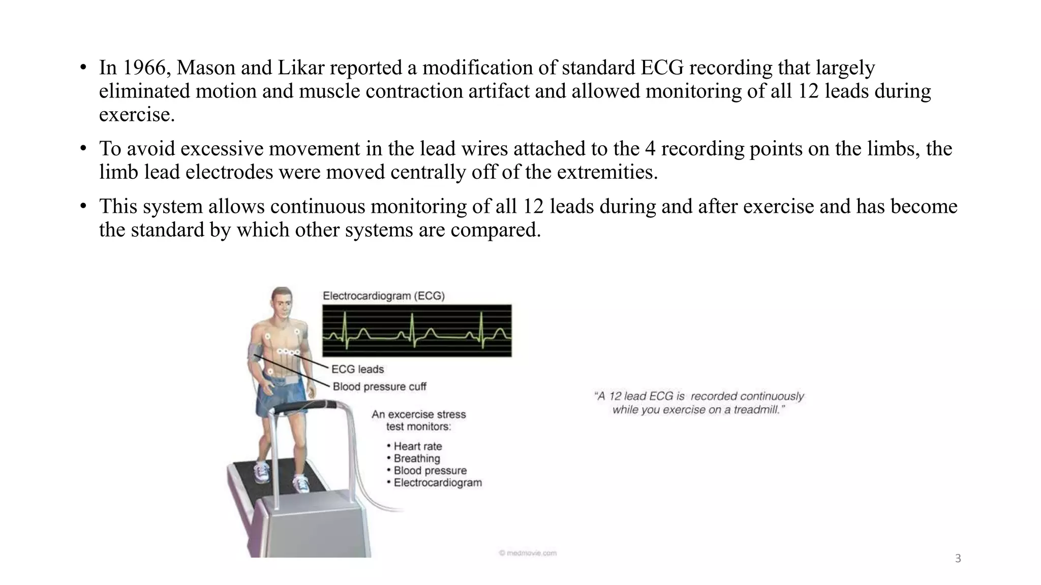 Placement Of Ecg Leads