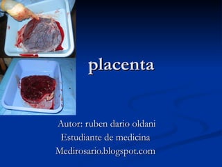 placenta Autor: ruben dario oldani Estudiante de medicina Medirosario.blogspot.com 