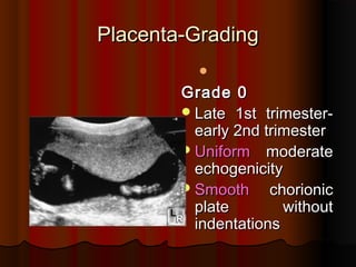 Placenta-Grading
Placenta-Grading

Grade 0
Grade 0
Late 1st trimester-
Late 1st trimester-
early 2nd trimester
early 2nd trimester
Uniform
Uniform moderate
moderate
echogenicity
echogenicity
Smooth
Smooth chorionic
chorionic
plate without
plate without
indentations
indentations
 