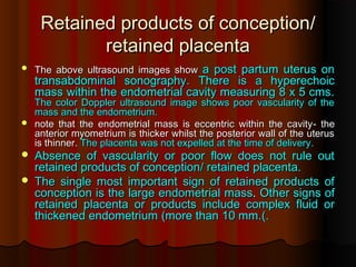 Retained products of conception
Retained products of conception/
/
retained placenta
retained placenta
 The above ultrasound images show
The above ultrasound images show a post partum uterus on
a post partum uterus on
transabdominal sonography
transabdominal sonography.
. There is a hyperechoic
There is a hyperechoic
mass within the endometrial cavity measuring 8 x 5 cms
mass within the endometrial cavity measuring 8 x 5 cms.
.
The color Doppler ultrasound image shows poor vascularity of the
The color Doppler ultrasound image shows poor vascularity of the
mass and the endometrium
mass and the endometrium.
.
 note that the endometrial mass is eccentric within the cavity
note that the endometrial mass is eccentric within the cavity-
- the
the
anterior myometrium is thicker whilst the posterior wall of the uterus
anterior myometrium is thicker whilst the posterior wall of the uterus
is thinner
is thinner.
. The placenta was not expelled at the time of delivery
The placenta was not expelled at the time of delivery.
.
 Absence of vascularity or poor flow does not rule out
Absence of vascularity or poor flow does not rule out
retained products of conception
retained products of conception/
/ retained placenta
retained placenta.
.
 The single most important sign of retained products of
The single most important sign of retained products of
conception is the large endometrial
conception is the large endometrial mass
mass.
. Other signs of
Other signs of
retained placenta or products include complex fluid or
retained placenta or products include complex fluid or
thickened endometrium
thickened endometrium (
(more than 10 mm
more than 10 mm.
.(
(.
.
 