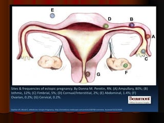 placenta-140315062308-phpapp01.pdf