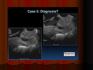 placenta-140315062308-phpapp01.pdf