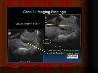placenta-140315062308-phpapp01.pdf