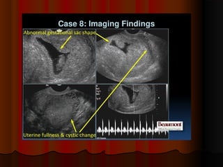 placenta-140315062308-phpapp01.pdf