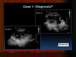 Placenta ultrasound