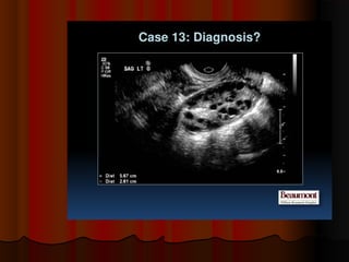 Placenta ultrasound