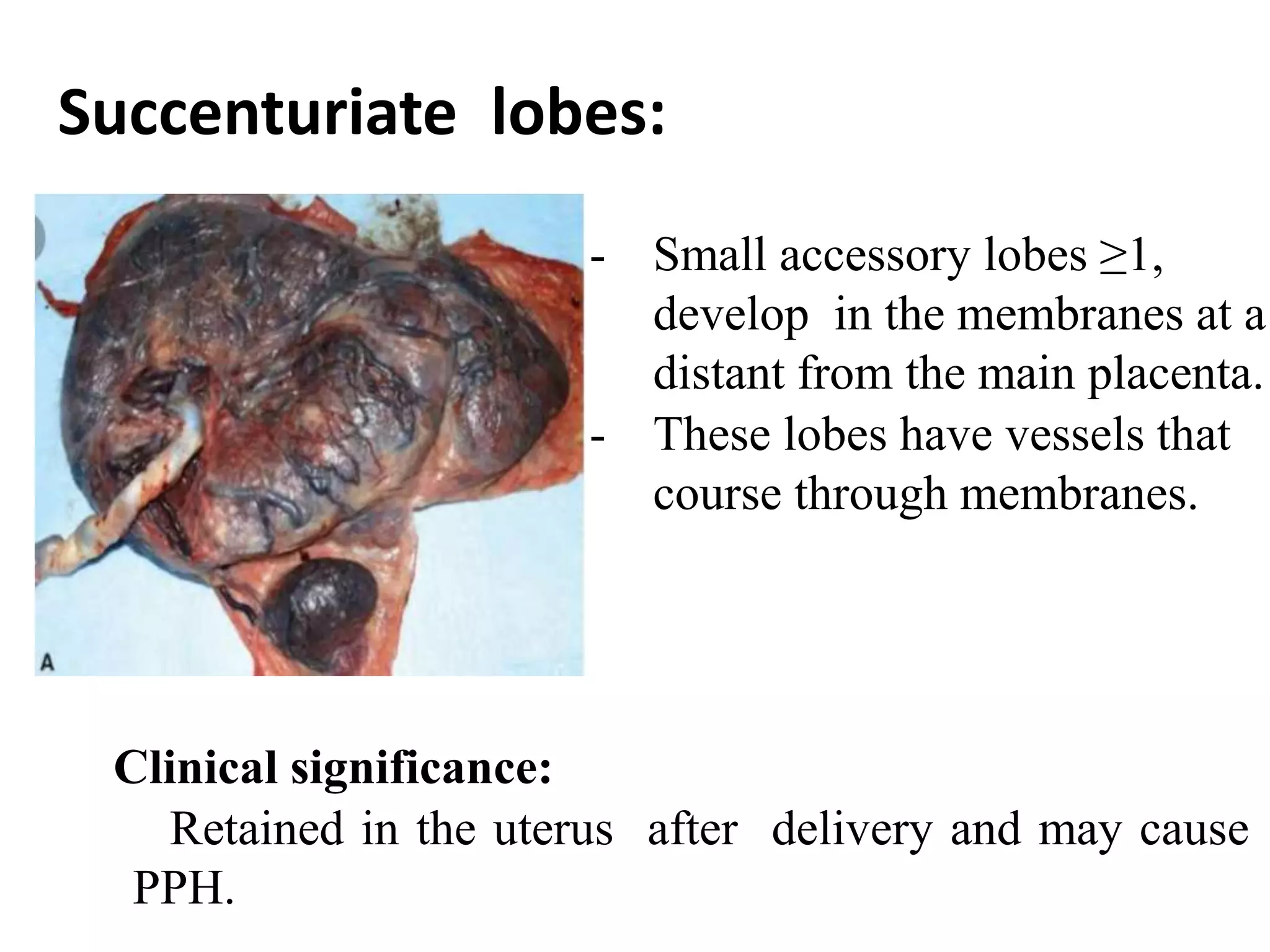 Placenta development and its abnormalities | PPTX