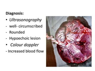 Diagnosis:
• Ultrasonography
- well- circumscribed
- Rounded
- Hypoechoic lesion
• Colour doppler
- Increased blood flow
 