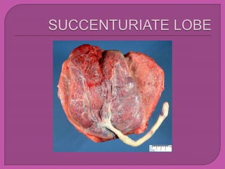 placenta.pptx