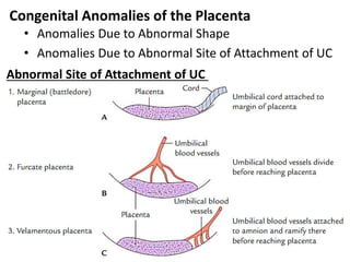 Congenital Anomalies of the Placenta
• Anomalies Due to Abnormal Shape
• Anomalies Due to Abnormal Site of Attachment of UC
Abnormal Site of Attachment of UC
 