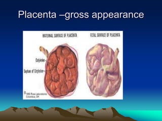 Placenta –gross appearance
 