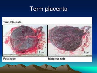 Term placenta
 