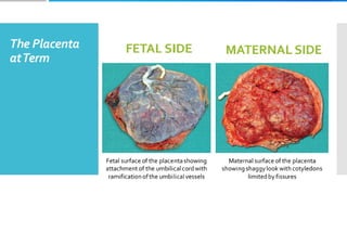 Placenta and placental anomalies and cord anomalies.pptx