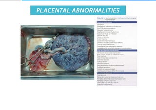 Placenta and placental anomalies and cord anomalies.pptx