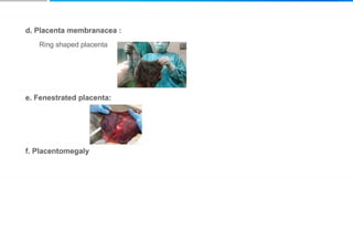 Placenta and placental anomalies and cord anomalies.pptx