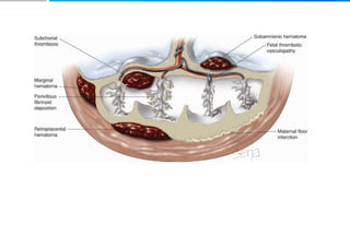 Placenta and placental anomalies and cord anomalies.pptx