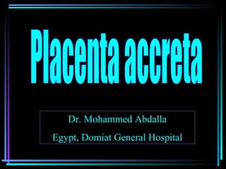Dr. Mohammed AbdallaDr. Mohammed Abdalla
Egypt, Domiat General HospitalEgypt, Domiat General Hospital
 