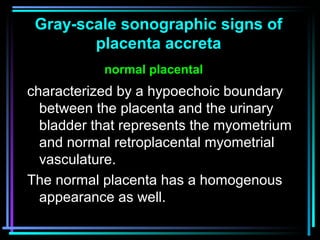 22
characterized by a hypoechoic boundary
between the placenta and the urinary
bladder that represents the myometrium
and ...