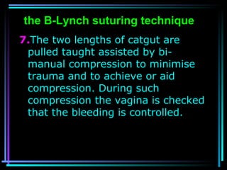 56
7.The two lengths of catgut are
pulled taught assisted by bi-
manual compression to minimise
trauma and to achieve or a...