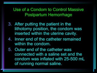 67
3. After putting the patient in the
lithotomy position, the condom was
inserted within the uterine cavity.
4. Inner end...