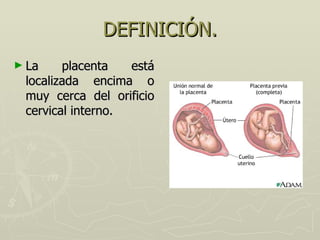 DEFINICIÓN. <ul><li>La placenta está localizada encima o muy cerca del orificio cervical interno. </li></ul>