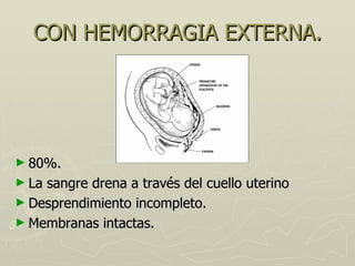 CON HEMORRAGIA EXTERNA. <ul><li>80%. </li></ul><ul><li>La sangre drena a través del cuello uterino </li></ul><ul><li>Despr...