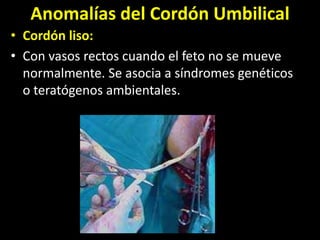 Anomalías del Cordón Umbilical
• Cordón liso:
• Con vasos rectos cuando el feto no se mueve
normalmente. Se asocia a síndromes genéticos
o teratógenos ambientales.
 
