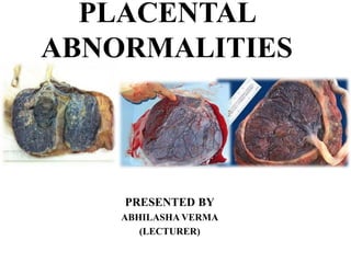 PLACENTAL
ABNORMALITIES
PRESENTED BY
ABHILASHA VERMA
(LECTURER)
 