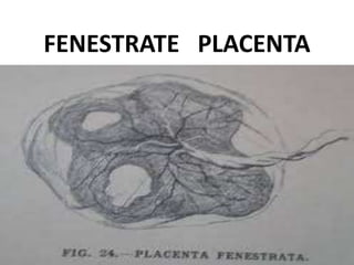 FENESTRATE PLACENTA
 