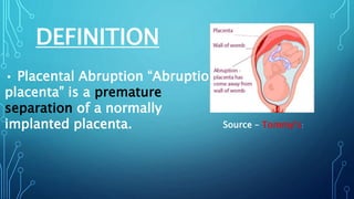 DEFINITION
• Placental Abruption “Abruptio
placenta” is a premature
separation of a normally
implanted placenta. Source – Tommy’s:
 