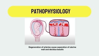 Pathophysiology
Degeneration of arteries cause separation of uterine
wall and decidua basalis
 
