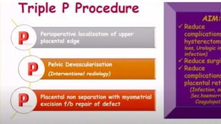 Placenta Accreta Spectrum PPTX