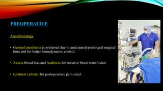PREOPERATIVE
Anesthesiology
• General anesthesia is preferred due to anticipated prolonged surgical
time and for better hemodynamic control.
• Assess blood loss and readiness for massive blood transfusion.
• Epidural catheter for postoperative pain relief.
 