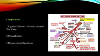 Complications:
1)Ligation of internal iliac vein, external
iliac artery.
2)Ureteral injury.
3)Retroperitoneal hematoma.
 