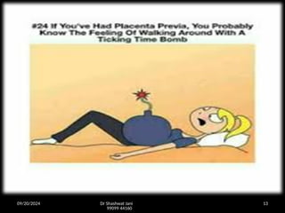 09/20/2024 Dr Shashwat Jani
99099 44160
13
 