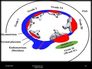 09/20/2024 Dr Shashwat Jani
99099 44160
20
 